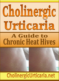 Cholinergic Urticaria: A Guide to Chronic Heat Hives